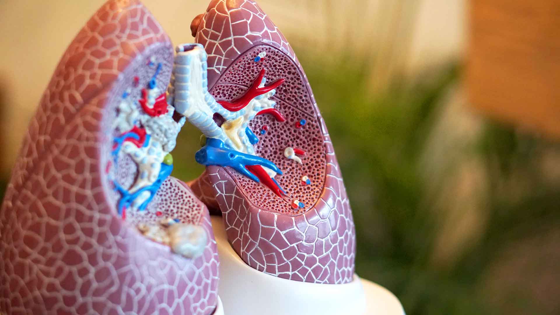 A plastic cross-section model of human lungs